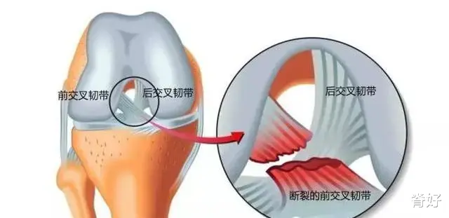 医院|美女练腿被围观进医院，庸医：这种腿别乱练