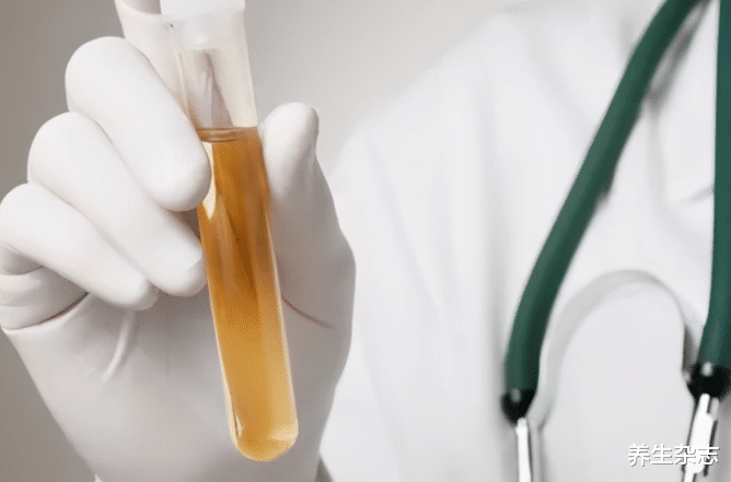 贫血|男子晨起瞄一眼“晨尿”，如果出现三种迹象，说明肾脏已被“侵害”