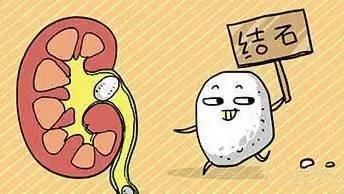 上海宏康|肾结石对我们身体都有哪些具体的危害