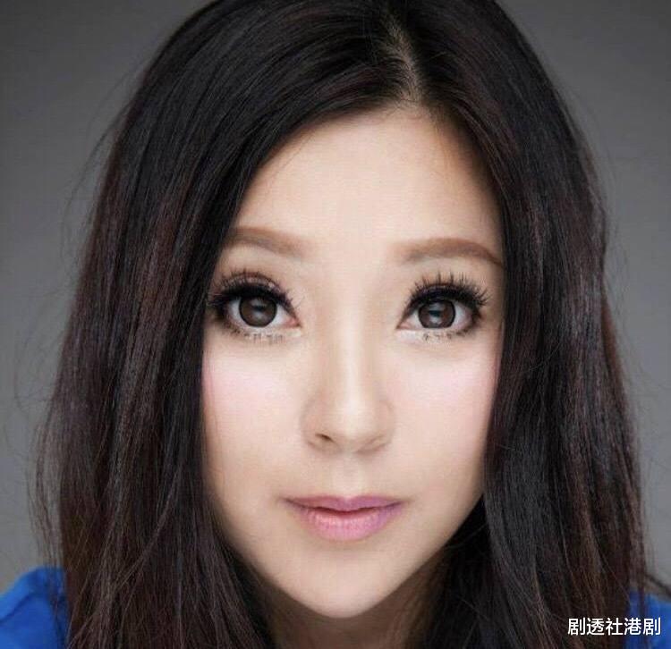 TVB|TVB90年代“五美”近况，有人整容成瘾变蛇精脸，有人未婚产子