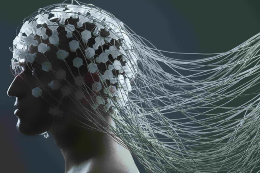 中国科学院 一个特殊病例：在死后10分钟还检测到大脑活动？死后真有生命吗？