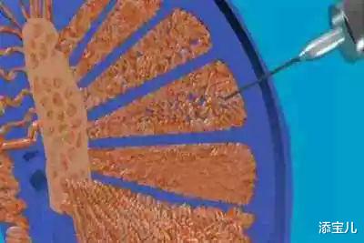 添宝儿|通过穿刺取出的精子做试管婴儿是否安全?