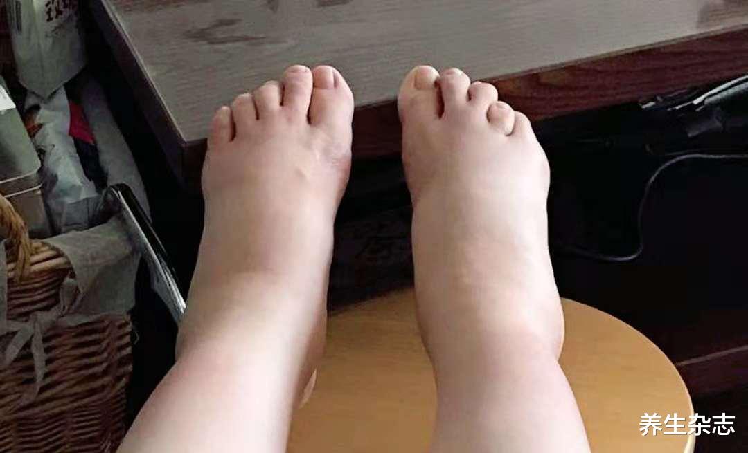 养生杂志|血管的“洗洁精”找到了,不是大豆,若你爱喝,血管畅通无阻