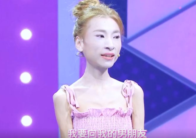 杨幂|“骷髅妹”刘野：自虐式减肥，120斤减到57斤，直接吓跑网恋对象
