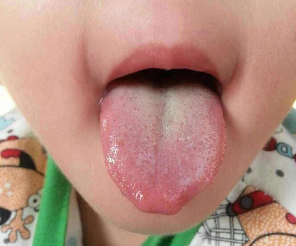 楚门妙手|孩子积食是个大问题，【整理】8个经典消食化积、健脾开胃的中成药，总有一个适合你家孩子