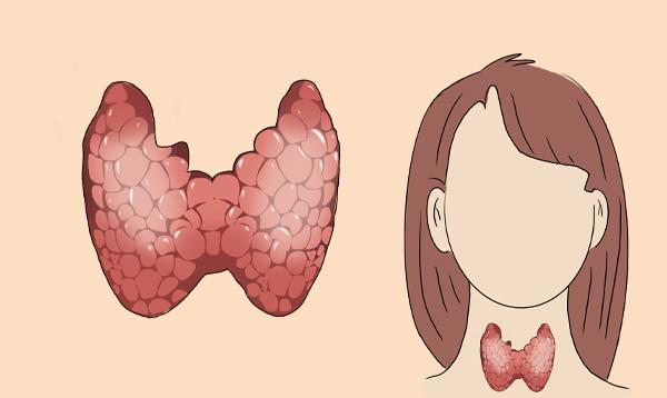 昧哥的快乐生活|糖尿病和甲状腺有关吗？优甲乐服用的5大问题，一文讲清楚