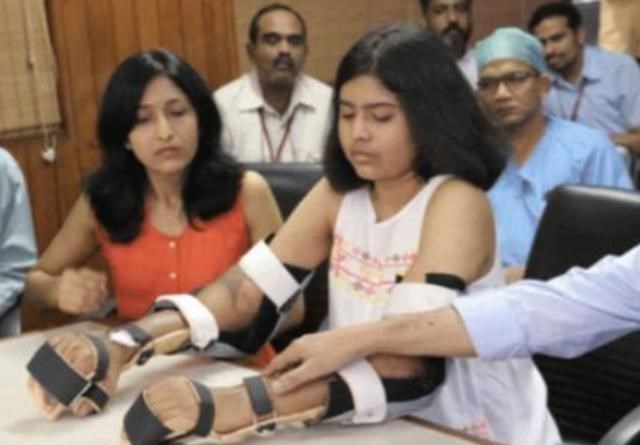 印度女孩因車禍失去雙臂，手術移植黑人手臂後，全身皮膚開始變黑-圖6