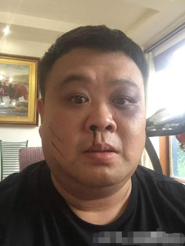 孙越|相声演员孙越的妻子，被网友调侃是带了假发的岳云鹏，福气满满的