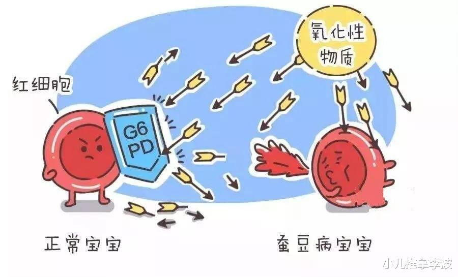 小儿推拿李波|中医儿科李波:什么是蚕豆病?蚕豆病有哪些注意事项和用药禁忌?