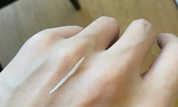 张杰|张杰：祸不单行，2个月内先后入院接受“鱼骨摘除和缝针”2项治疗