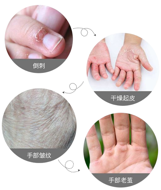 达人秀一秀 那些每天都擦护手霜的人，手怎么样了？