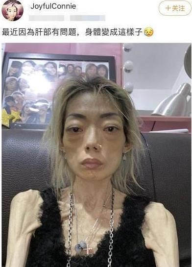 豪门|从公主到“怪物”：她放弃名校嫁入豪门，8年后全身瘫痪牙齿掉光