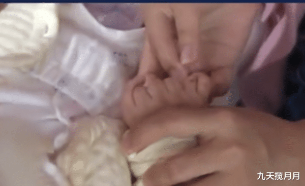 九天揽月月|三个月大的婴儿，竟长出31根指头，网友说：活久见