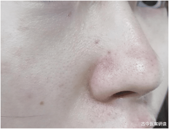 千疮百孔|男性晨起若有4个异常，胃或许“千疮百孔”，一个不占，胃还算“坚强”