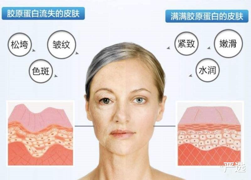 严选|周迅无法面对衰老在家哭，医美抗衰老风险大，如何正确抗衰老？