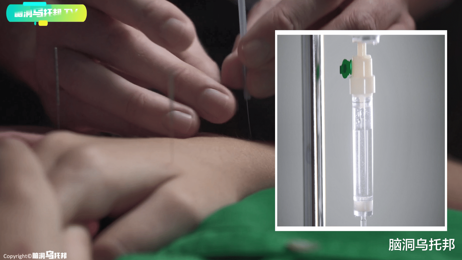 经络|主宰生死的隐形器官！人体灵魂之所在，现代医学无法复刻的医术