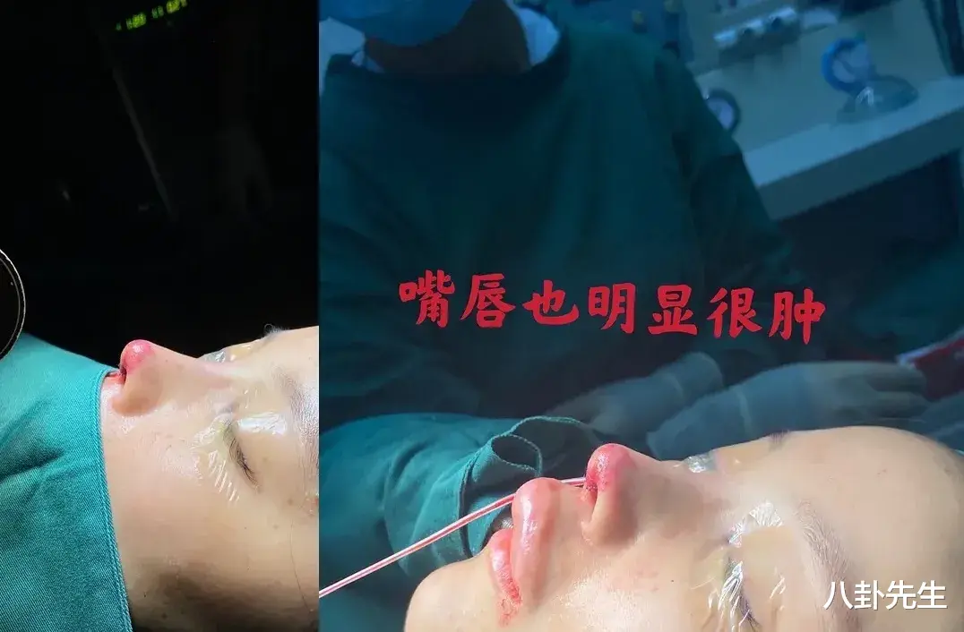 张萌|明明已经挺漂亮，却非要折腾脸的7大女星