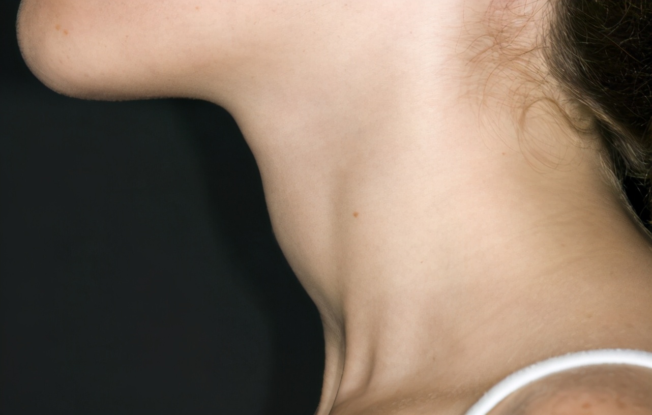 甲状腺结节|43岁大姐甲状腺结节转癌，提醒：3种食物或是癌变“加速剂”，别再贪吃