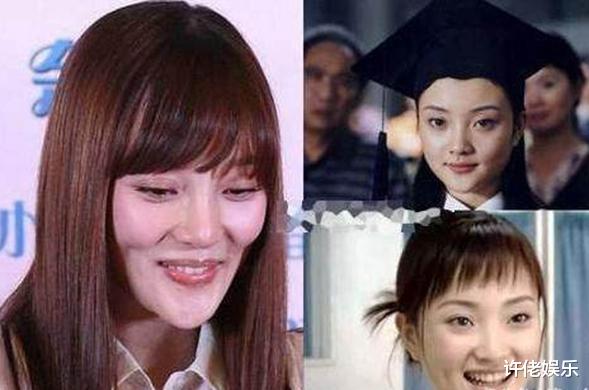 整容|“整容最失败”的女星，她们明明天生丽质，却活生生地整成老巫婆