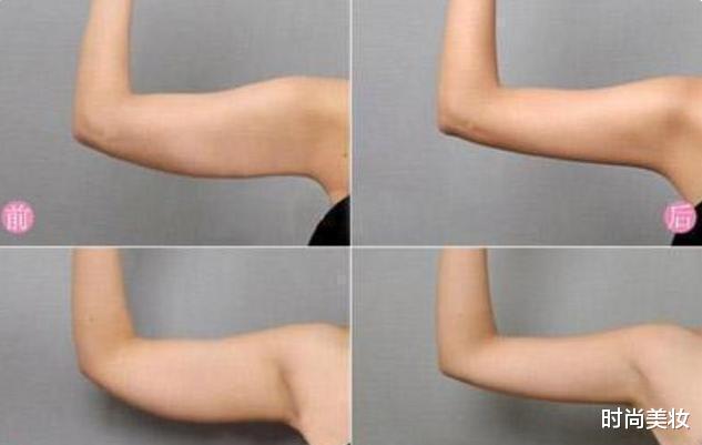 运动|要想快速燃烧脂肪,可以做这两项运动,长期坚持就会看到效果