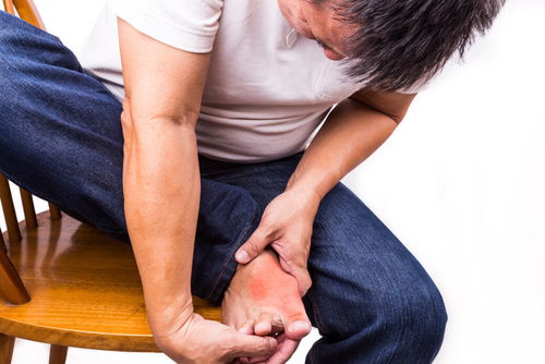 尿酸|40岁男子，尿酸降到了358，用了3个月的时间，大家应该学习他的方法