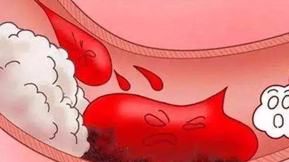 香艾儿 为什么你老得这么快?