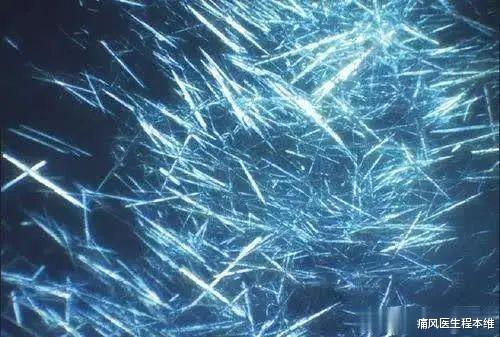 痛风|治疗痛风需要牢记的5个数字密码！让你的治疗不再费劲！