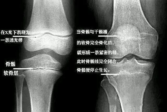 布谷妈妈|53万儿童“性早熟”，这些食物正“催熟”我们的孩子，很多家长还成箱买