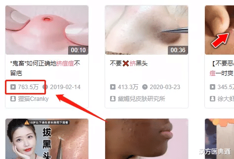 汉方医典通|20年痘痘被挤破，场面堪比恐怖片，网友直呼受不住。