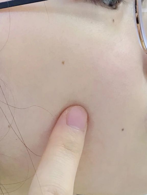 医生 孕期不能护肤,会致畸?皮肤科医生:孕期护肤看2点就够