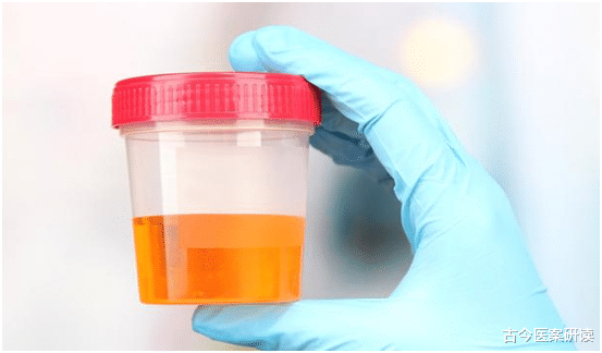 古今医案研读|为何肝癌患者越来越多?医生提醒:身体一旦出现“2红、2黄”,尽早检查