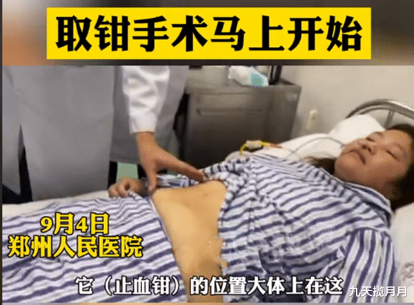 九天揽月月|女子剖腹产后腰疼1年，腹中竟有15公分止血钳，网友：这也太吓人了