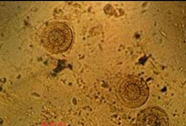 蔡嘉宇宝妈日记|在水产养殖中,轮虫是合适的开口饵料,但是在喂食的过程中不会导致鱼苗患上轮虫病吗?