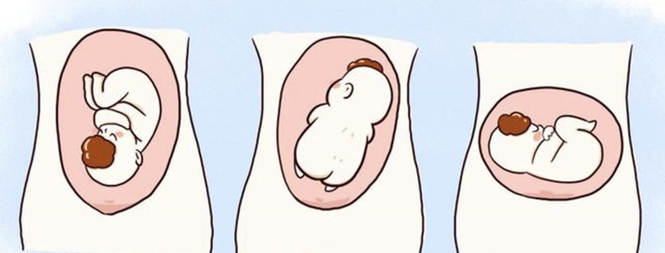 艳燕聊育儿|孕晚期胎位不正怎么办？看看这位孕妈怎么做！