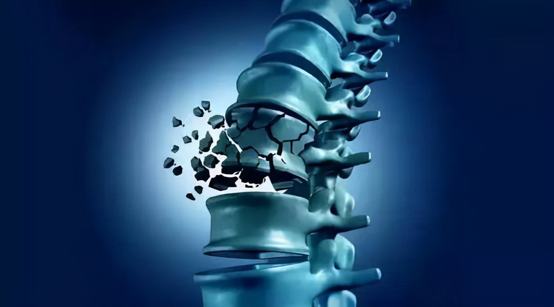 骨质疏松|骨质疏松惧怕的3种水果，医生：你若爱吃，骨骼或能壮如“牛”