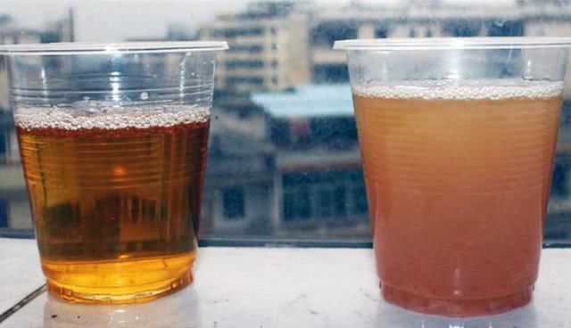 蛋白尿|蛋白尿从16克降到1克以下！这位肾友的经历值得学习