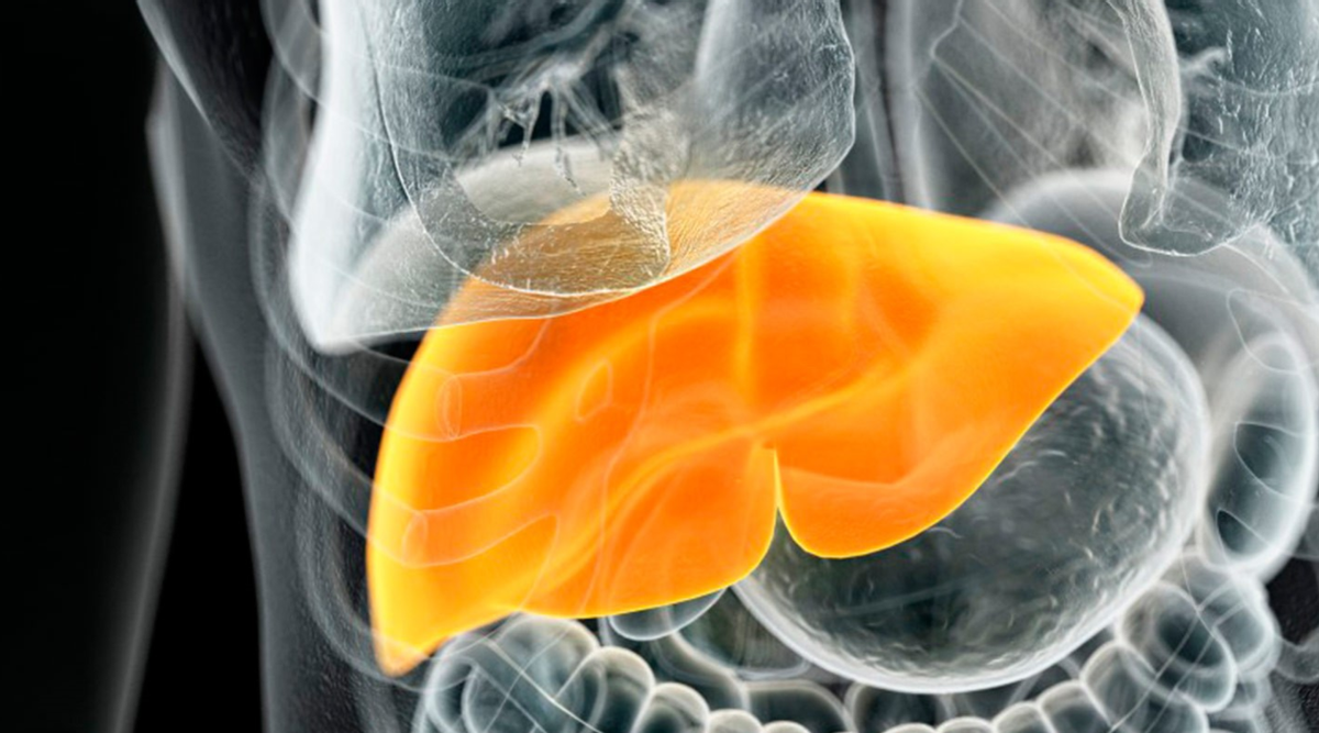 脂肪肝|43岁包租公，从脂肪肝到肝功能正常仅用100天，肝科主任：方法值得借鉴