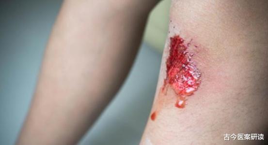 转氨酶|42岁男子仅用三个月,转氨酶从320降至35,病人自述:可多吃这两种食物