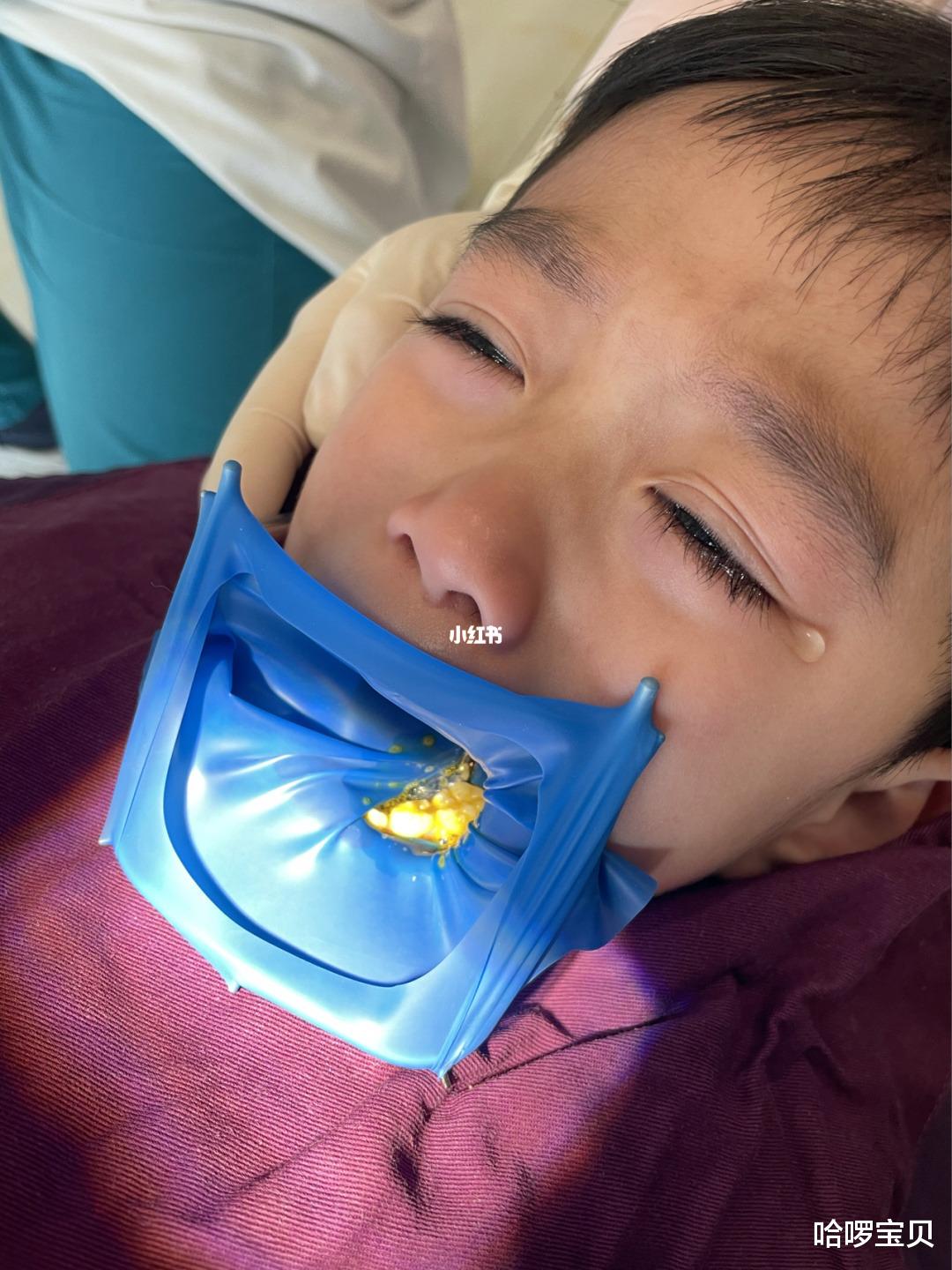 哈啰宝贝|5岁小孩没有蛀牙却反复牙痛，医生建议：这个高科技别太早给孩子用