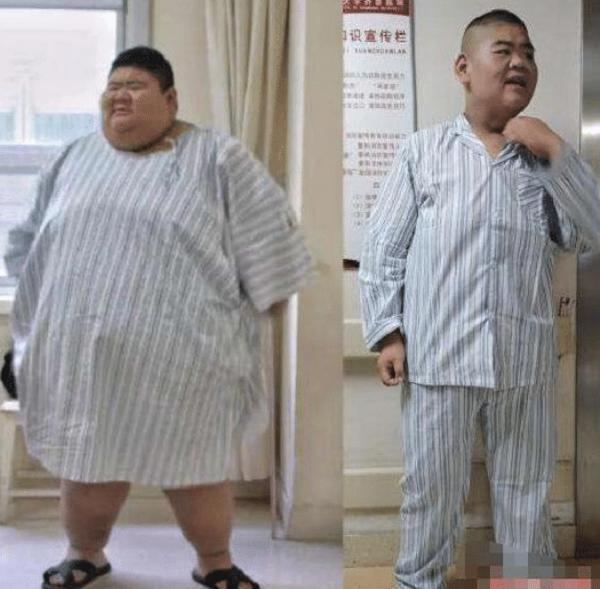 运动|疯狂减肥的大胖子，体重高达668斤，一年瘦掉400斤，结果怎么样？