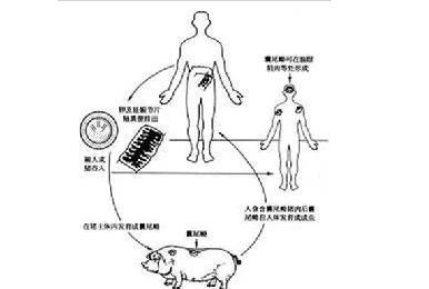 猪肉|吃掉脸、钻进眼,隐藏在人体内恐怖的“寄生虫”,你知道几个?