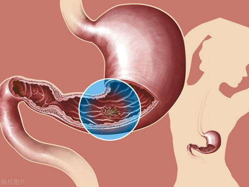 紫薯银耳羹|牛奶虽好，但不适合4类人群饮用，请告知亲友