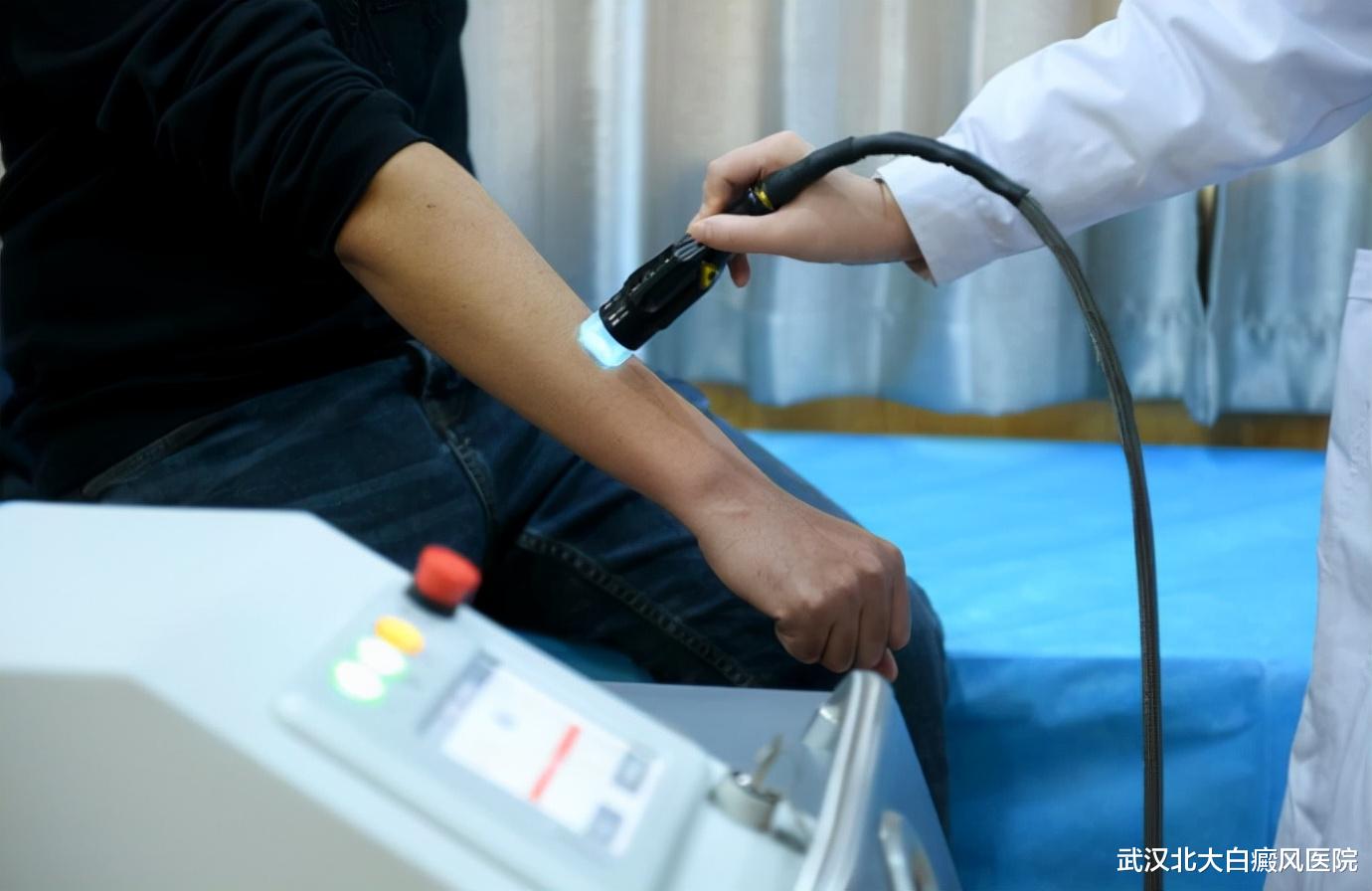 武汉北大白癜风医院|光疗治疗白癜风，这5大因素影响着光疗效果！