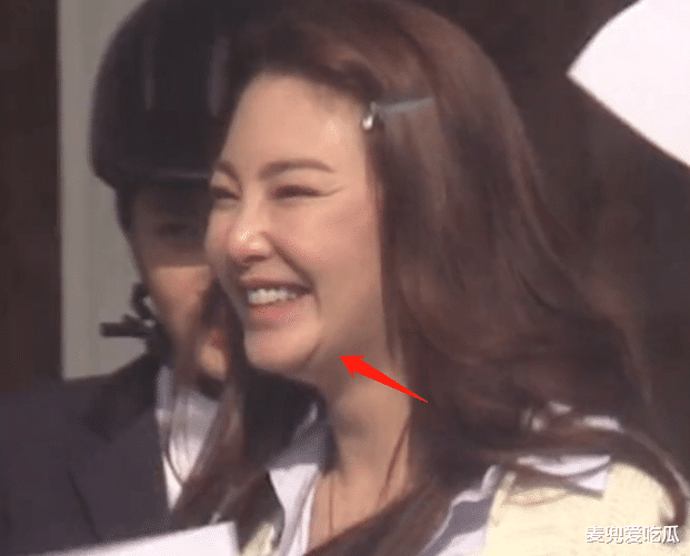 张雨绮|张雨绮颜值翻车?面部浮肿皱纹明显,生图暴露真实年龄