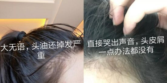 kiki有尚 双11吃土也要买的3款洗发水，平价小众、控油去屑，孕妈：整箱屯