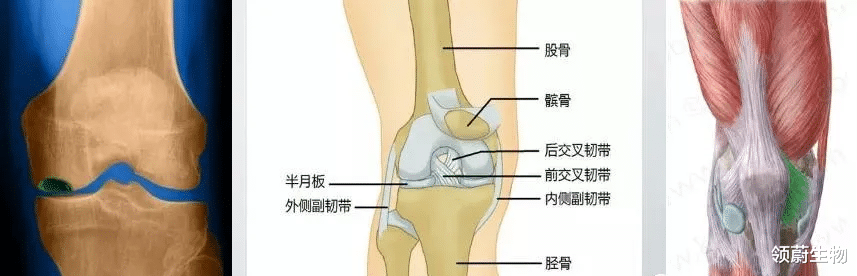 火龙果|你知道吗？全身关节这么多，为什么偏偏膝关节最容易发炎？