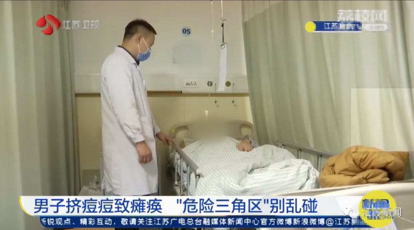 亚洲播报一姐 男子挤了颗痘痘，竟然导致上肢瘫痪！这里的痘痘千万别乱碰