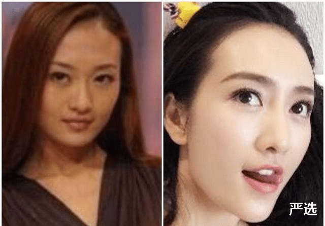 严选|连续打了6年“美白针”的女人，如今怎么样了？网友：难以置信