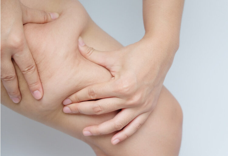 脂肪瘤|脂肪瘤是怎么引起的?怎么判断脂肪瘤是良性还是恶化?