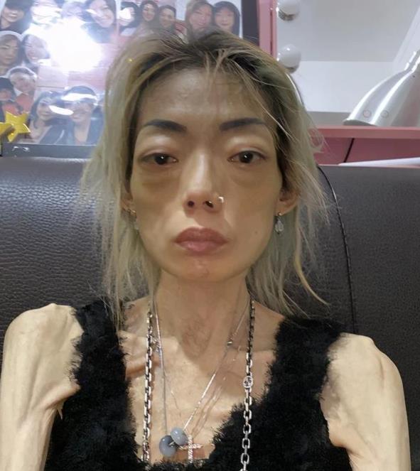 叶童|许仙扮演者近况曝光，发如枯草瘦成“纸片”，吃路边摊还一脸满足